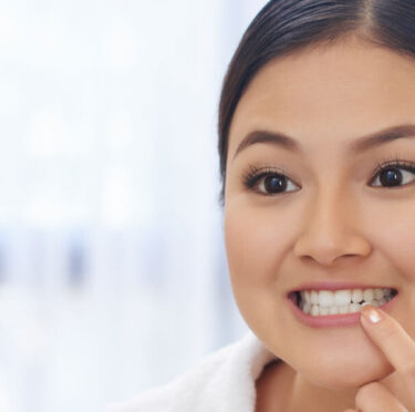 Fluoride Treatment: Why is it Important for Adults
