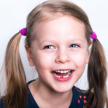 Who Can Benefit from Dental Sealants