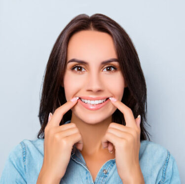 How to Care for Your Teeth After Dental Bonding