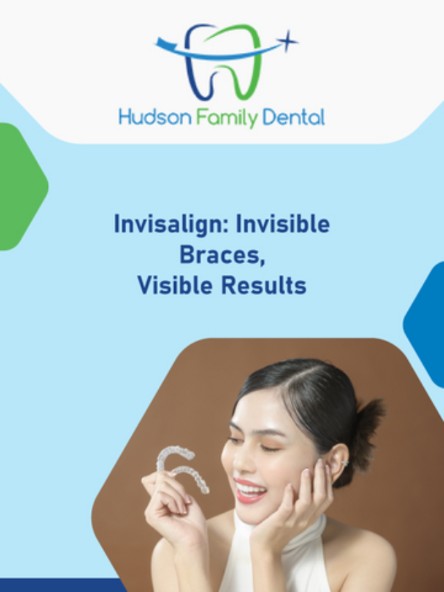 Invisalign: Invisible Braces, Visible Results